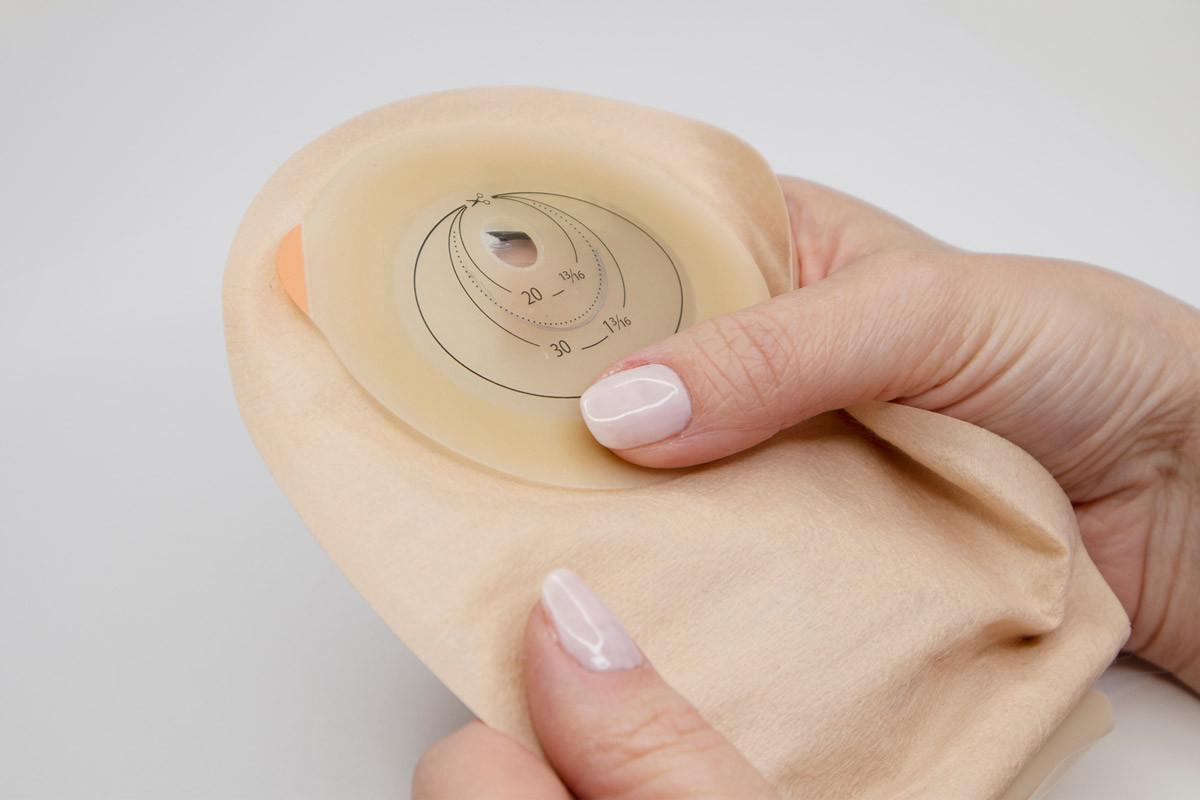 managing-stoma-care.jpg