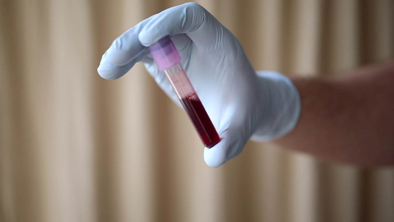 Blood Transfusion Awareness.jpg
